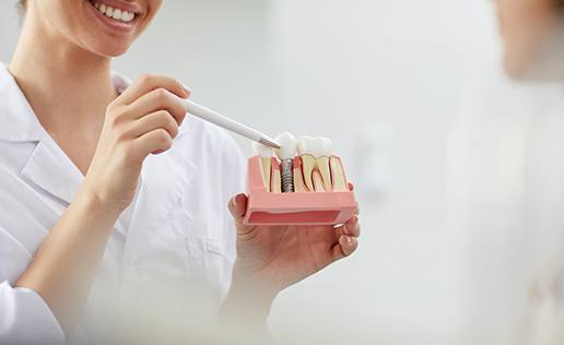a dentist pointing to a dental implant model